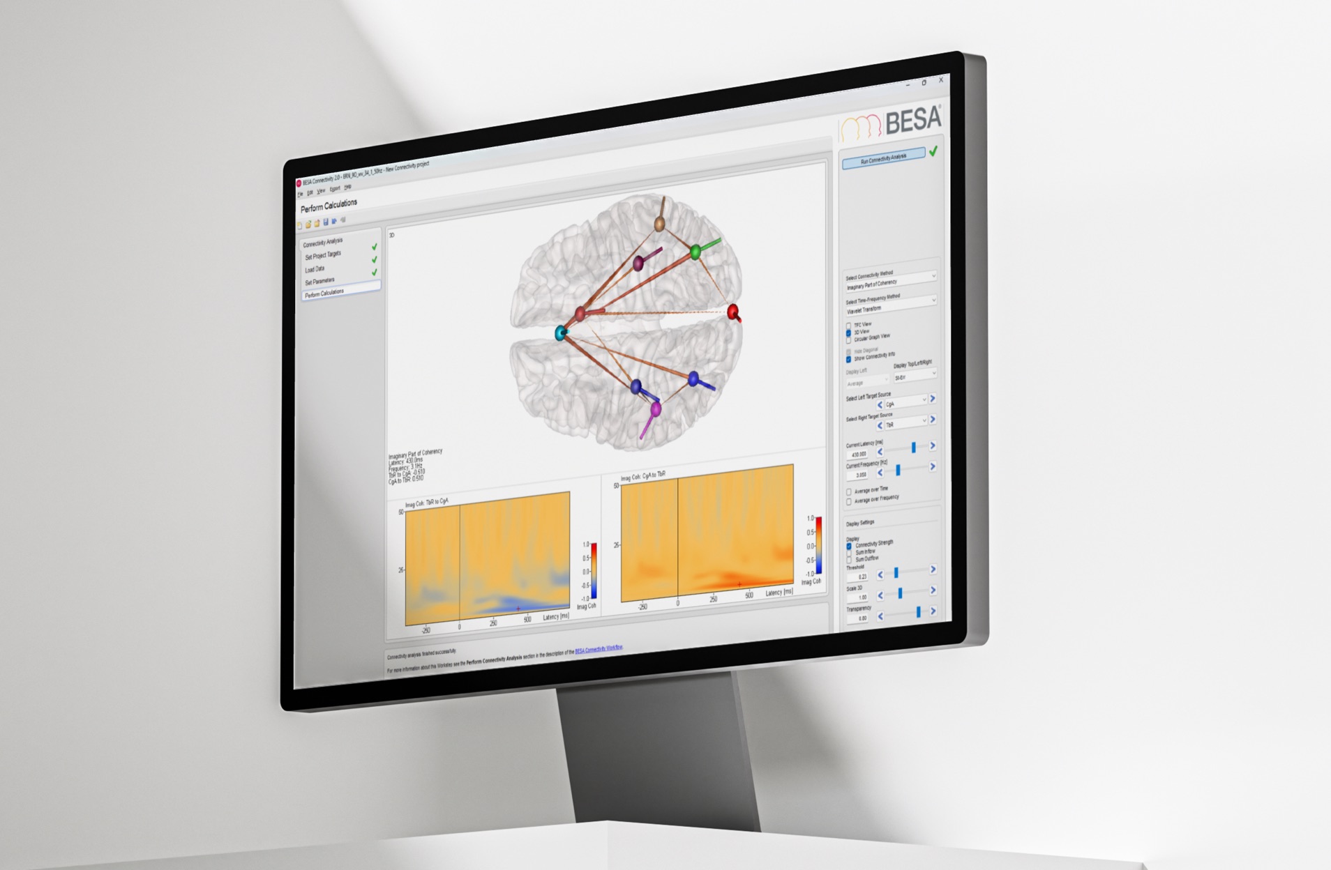 BESA Connectivity 3D brain view with time-frequency coherence plots between source regions