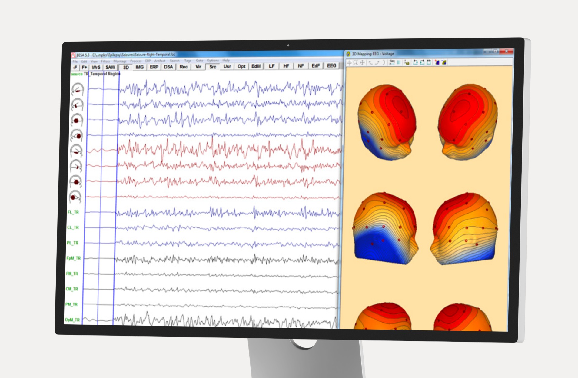 Workstation displaying live EEG waveforms and source localization maps