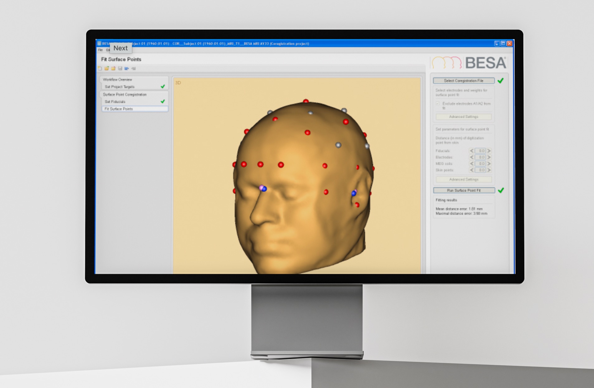 BESA MRI surface point fit showing a coregistered head model with digitized electrode positions